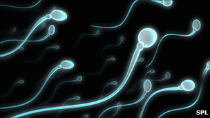 Mouse sperm