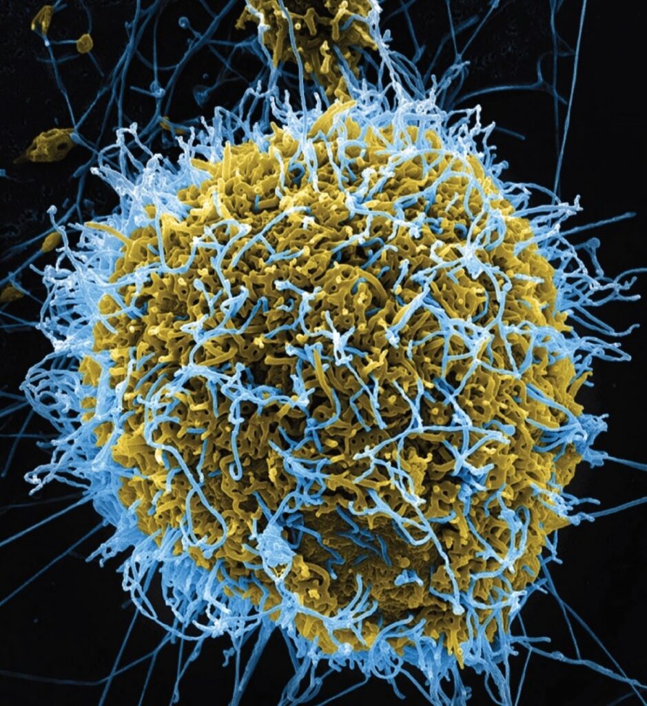 Ebola virus